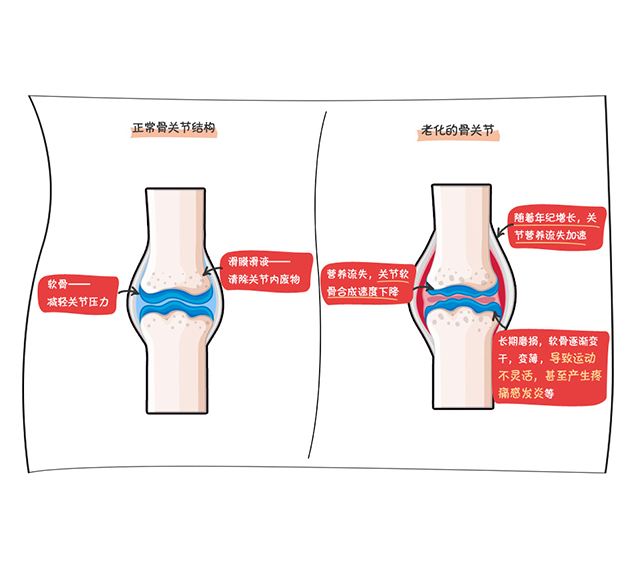 骨关节健康预防方式备受重视，更渴望同步调理多种健康问题